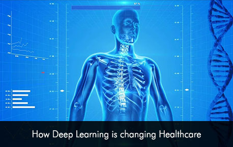 How Deep Learning is changing Healthcare