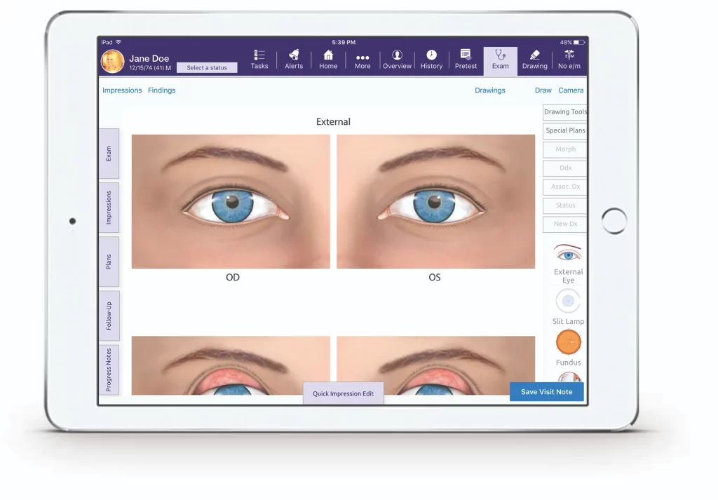 ModMed EMR Software Demo with Optometry and Ophthalmology EHR Dashboard