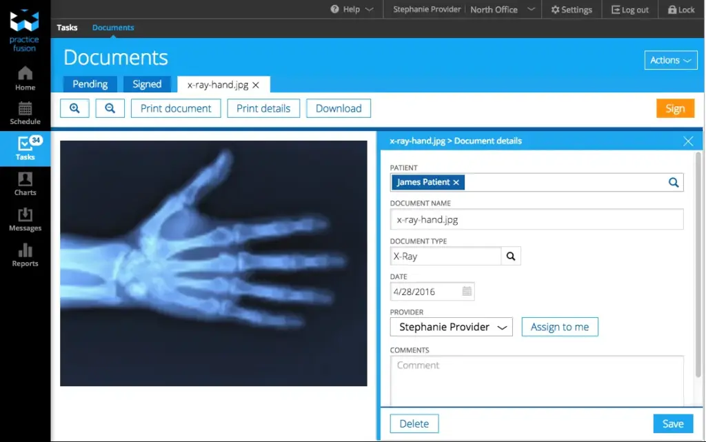 Blue-toned X-ray image of a patient's hand showing finger and wrist bones