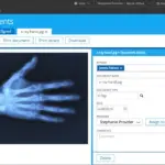 Blue-toned X-ray image of a patient's hand showing finger and wrist bones