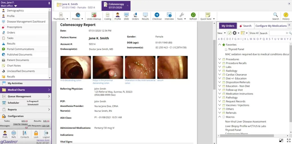 gGastro EHR and Gastroenterology EMR software patient medical chart with colonoscopy report screenshot.