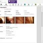 gGastro EHR and Gastroenterology EMR software patient medical chart with colonoscopy report screenshot.