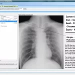 ECLIPSE Practice Management software patient document list and chest x-ray view dashboard screenshot.