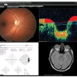 EyeMD-EMR-and-Practice-Management-Software-Demo