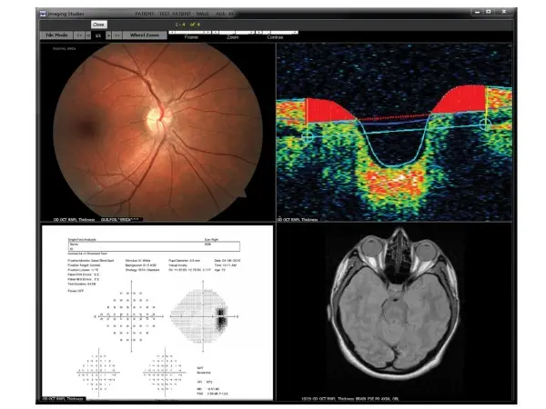 EyeMD-EMR-and-Practice-Management-Software-Demo