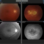 IntelleChart EHR Software-ophthalmology EMR Software