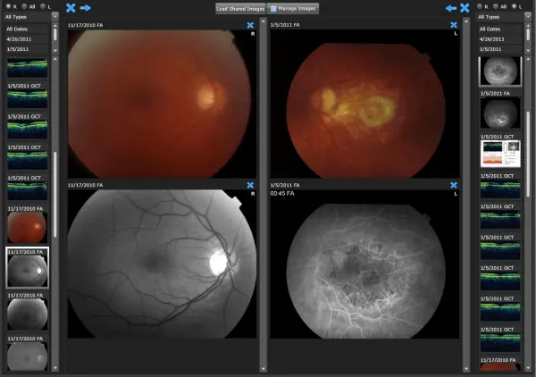 IntelleChart EHR Software-ophthalmology EMR Software