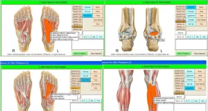 ICS SammyEHR software foot anatomy and diagnosis screenshot.