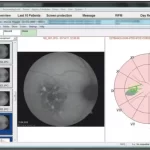 ifa-EMR-Software-Eye-Draw-software