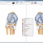 Compulink-Orthopedic-Advantage-EMR-Software-Patient-Portal-Demo