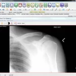 Compulink-Orthopedic-Advantage-EMR-Software-and-Radiology-Demo