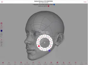 EZDERM EMR software dermatology emr
