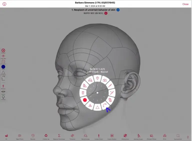 EZDERM EMR software dermatology emr