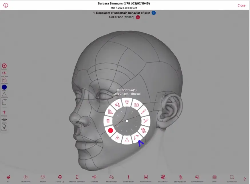 EZDERM EMR software dermatology emr