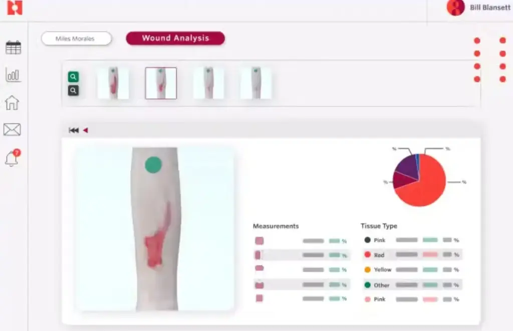 Agility-by-Net-Health-EMR-Software-wound-analysis