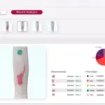 Agility-by-Net-Health-EMR-Software-wound-analysis