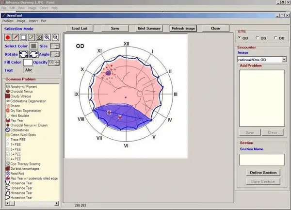 Medflow-EMR Software Eye drawing tool EHR Software dashboard screenshot.