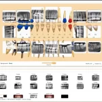 Curve Dental EHR Practice Management Software Charting Demo