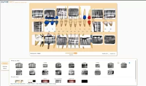 Curve Dental EHR Practice Management Software Charting