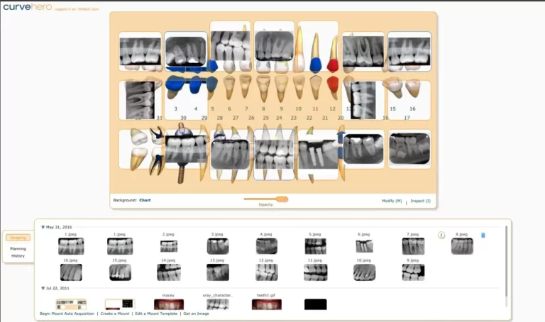 Curve Dental EHR Practice Management Software Charting
