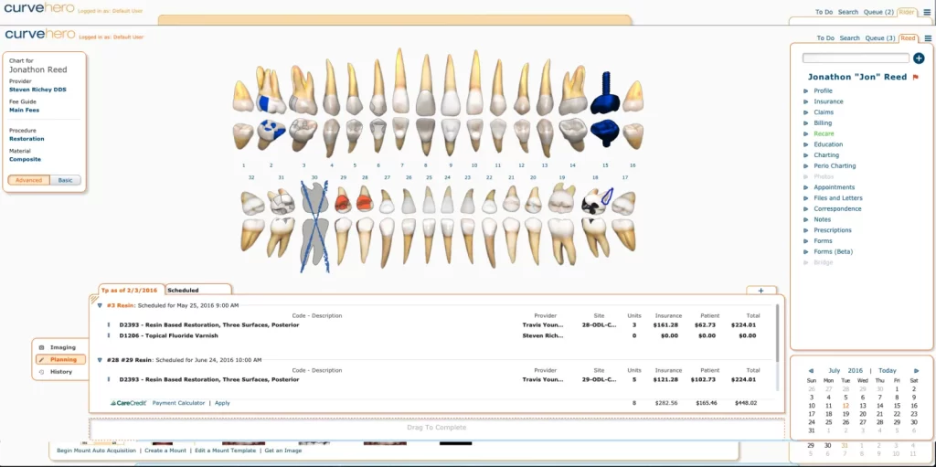 Curve Dental EHR software patient dental charting and scheduling screenshot.
