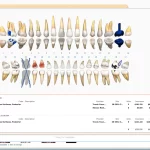 Curve Dental EHR software patient dental charting and scheduling screenshot.