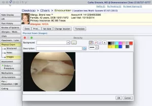 Sevocity EHR software patient exam image and patient encounter details screenshot.