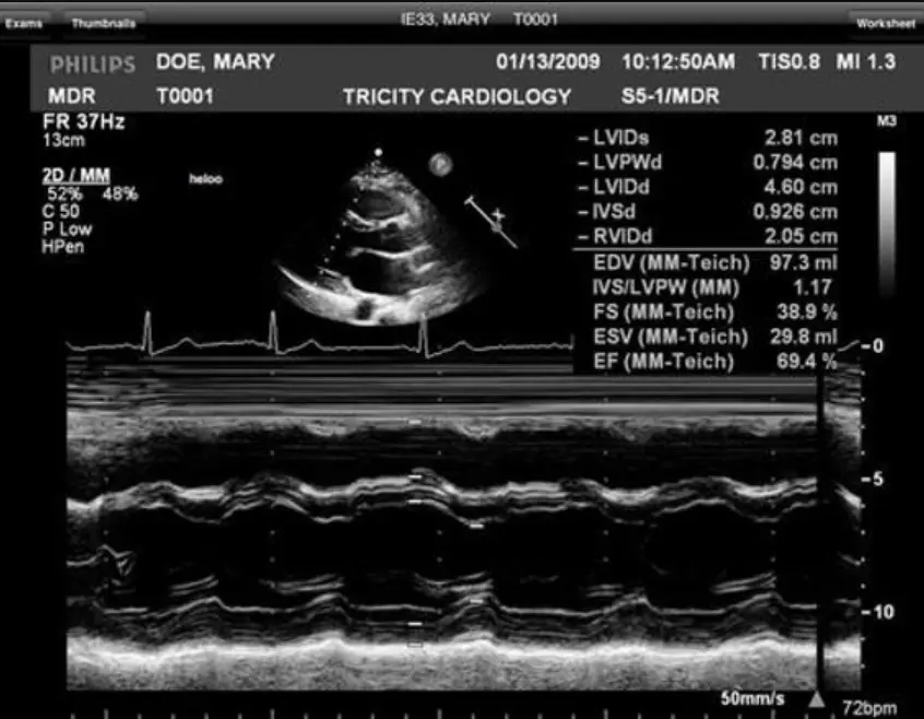UltraLinq Medical Imaging Software