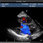 UltraLinq HealthCare Solutions EMR Practice Management Software Ultrasound