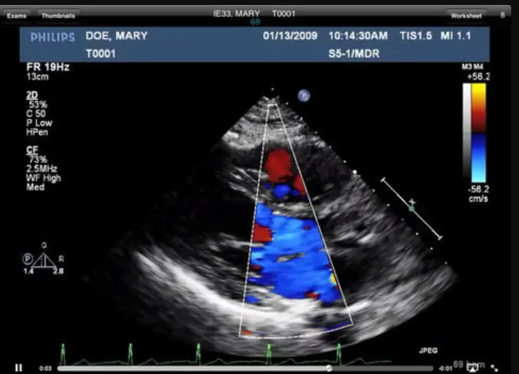 UltraLinq HealthCare Solutions EMR Practice Management Software Ultrasound