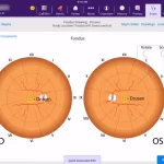 EMA Telehealth Enabled EHR Practice Management Software Diagnosis