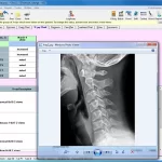 EZBIS EHR software cervical X-ray and X-ray notes dashboard screenshot.