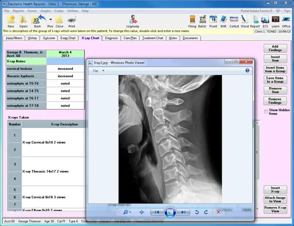 EZBIS EHR software cervical X-ray and X-ray notes dashboard screenshot.