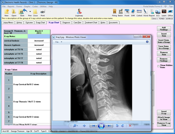 EZBIS Office EMR Software EHR and Practice Management Software