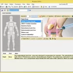 Phoenix Ortho EHR Software orthopedic treatment details interface screenshot.