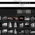 Carestream Dental EMR Software general patient demo