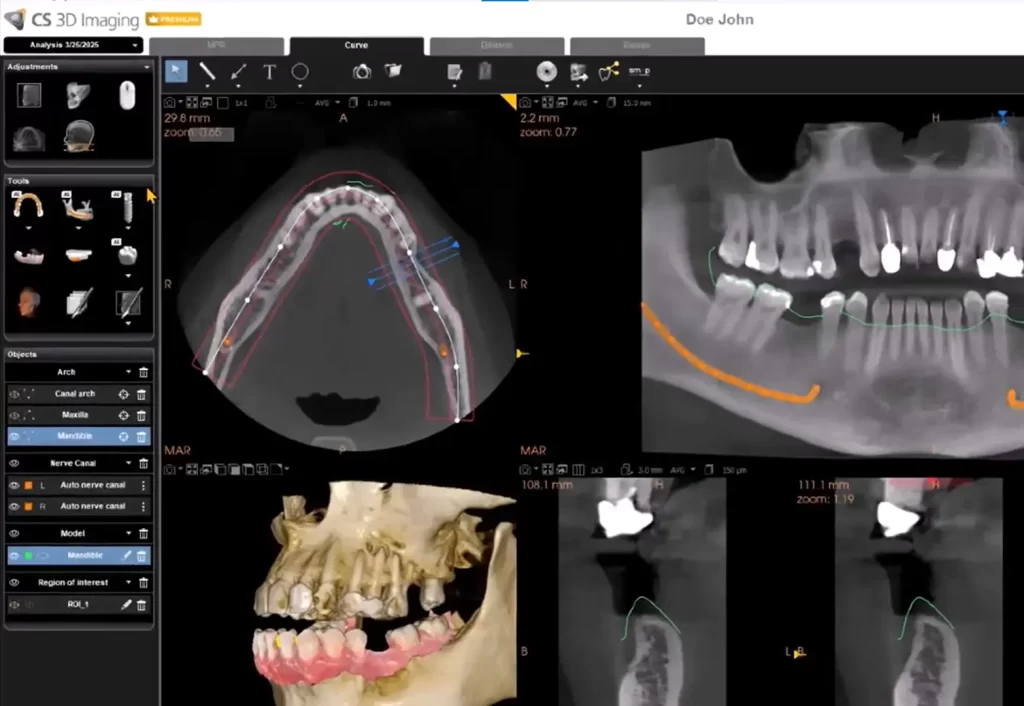 Carestream EMR Software & Dental imaging practice management software