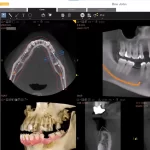 Carestream EMR Software & Dental imaging practice management software