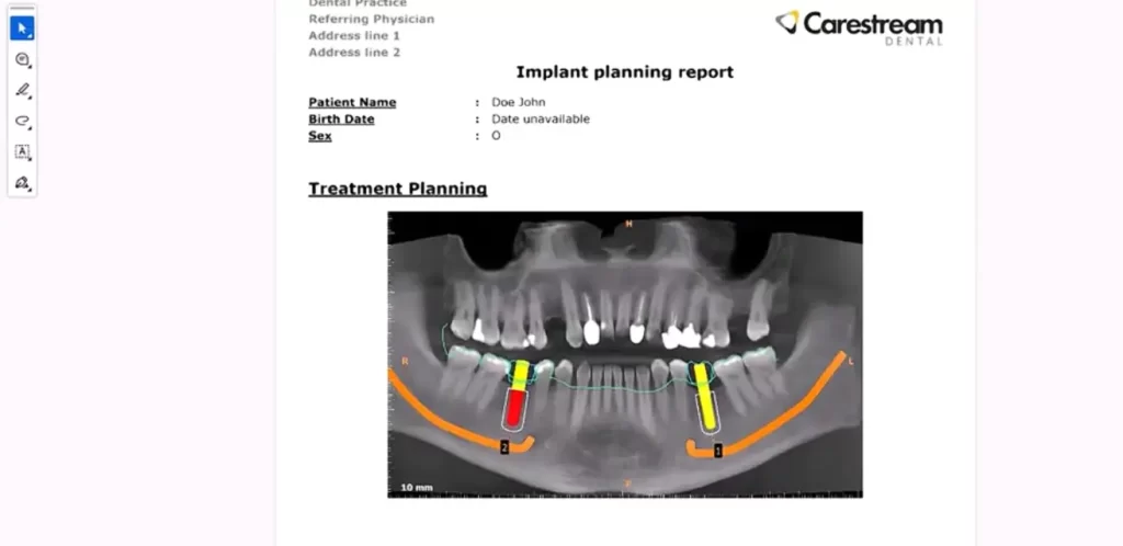 Carestream Dental EMR Software & digital imaging EHR Software