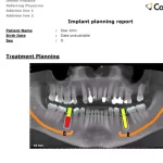 Carestream Dental EMR Software & digital imaging EHR Software