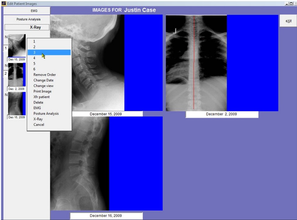 Atlas Chiropractic EHR Software EHR and Practice Management Software