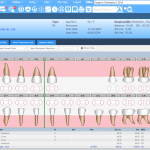 Denticon Practice Management Software Solution by plant DDS.