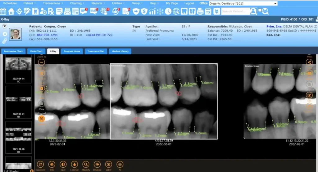 Planet DDS EHR Practice Management Software X Ray