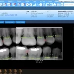 Planet DDS EHR Practice Management Software X Ray