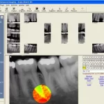 Eaglesoft-Dental-Practice-Management-EMR-Software-Advanced-Demo