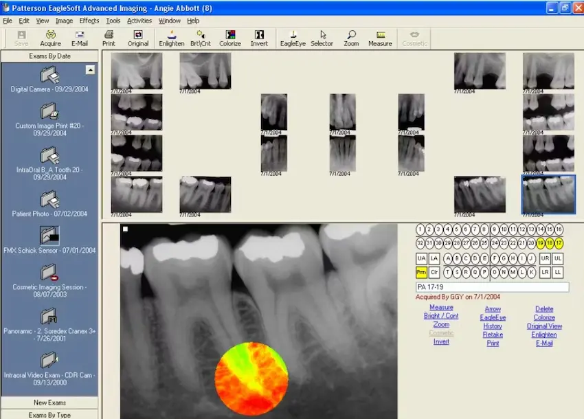Eaglesoft-Dental-Practice-Management-EMR-Software-Advanced-Demo