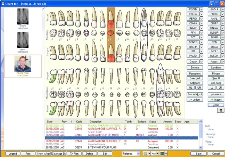 Egalesoft Practice Management software showing dental chart and procedure planning tools.