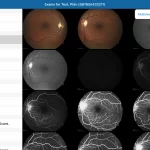 Eyefinity-EHR-and-Practice-Management-Software-Patient-Exam