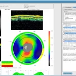 Liquid-EHR-SofImage-Capture-IR-Note-Builder