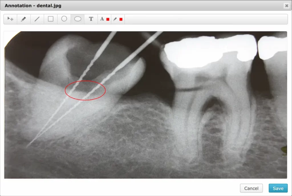 chARM-dentistry-EHR-Software-and-patient-portal
